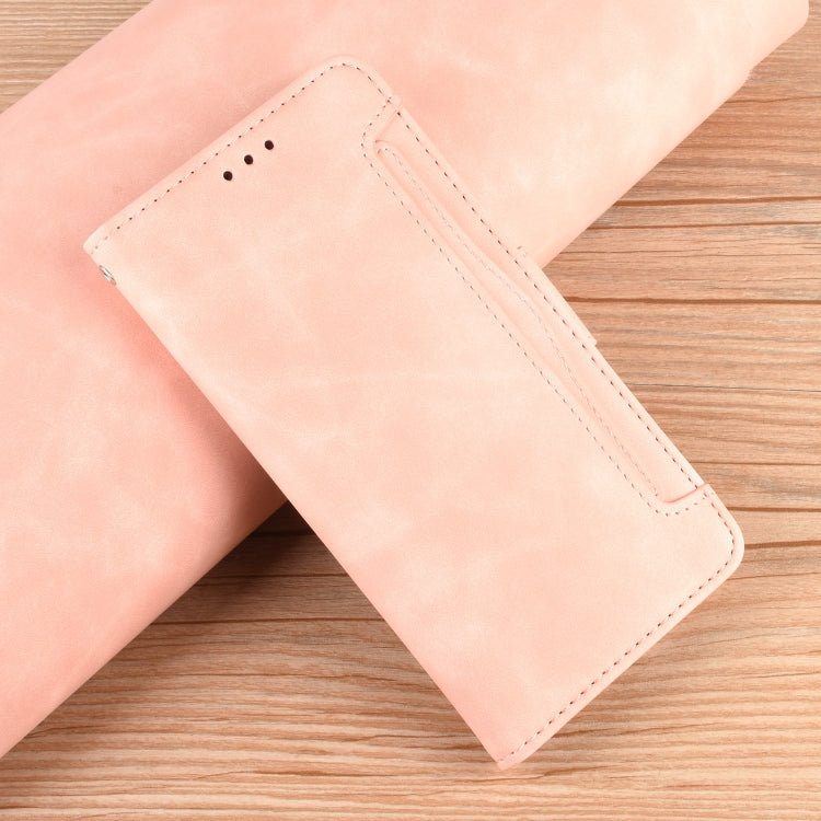 For Ulefone Armor X9 Skin Feel Calf Pattern Leather Phone Case(Pink) - Ulefone Cases by PMC Jewellery | Online Shopping South Africa | PMC Jewellery | Buy Now Pay Later Mobicred