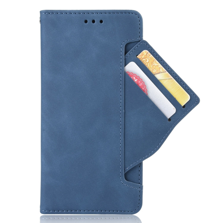 For Ulefone Note 13P Skin Feel Calf Pattern Leather Phone Case(Blue) - Ulefone Cases by PMC Jewellery | Online Shopping South Africa | PMC Jewellery | Buy Now Pay Later Mobicred