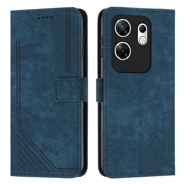 For Infinix Zero 30 4G Skin Feel Stripe Pattern Leather Phone Case with Lanyard(Blue) - Infinix Cases by PMC TechLife | Online Shopping South Africa | PMC TechLife | Buy Now Pay Later Mobicred
