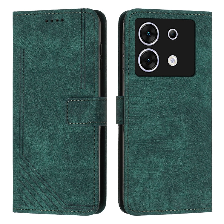 For Infinix Zero 30 5G Skin Feel Stripe Pattern Leather Phone Case with Lanyard(Green) - Infinix Cases by PMC Jewellery | Online Shopping South Africa | PMC Jewellery | Buy Now Pay Later Mobicred