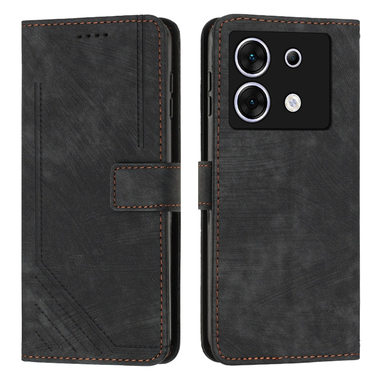 For Infinix Zero 30 5G Skin Feel Stripe Pattern Leather Phone Case with Lanyard(Black) - Infinix Cases by PMC TechLife | Online Shopping South Africa | PMC TechLife | Buy Now Pay Later Mobicred