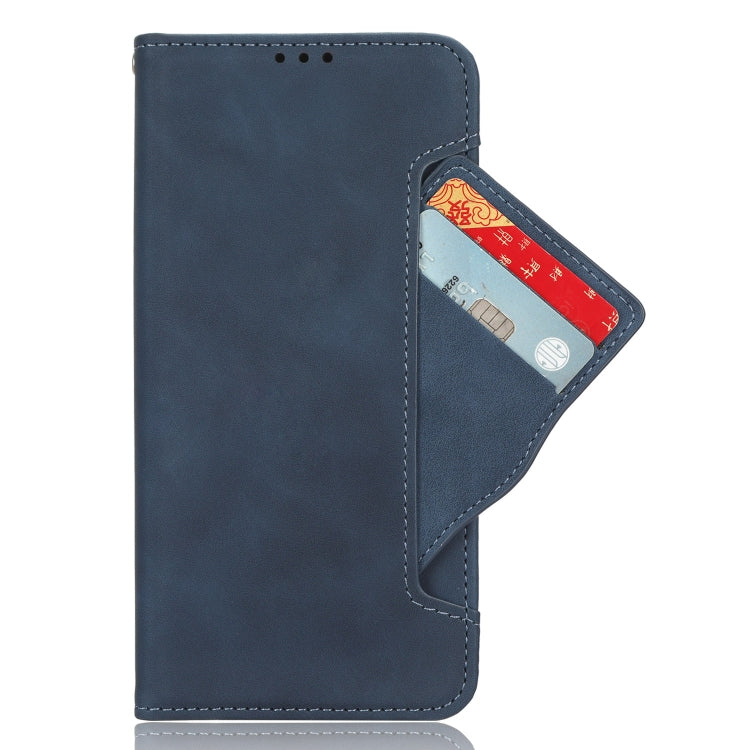 For Ulefone Note 16 Pro Skin Feel Calf Texture Card Slots Leather Phone Case(Blue) - Ulefone Cases by PMC Jewellery | Online Shopping South Africa | PMC Jewellery | Buy Now Pay Later Mobicred