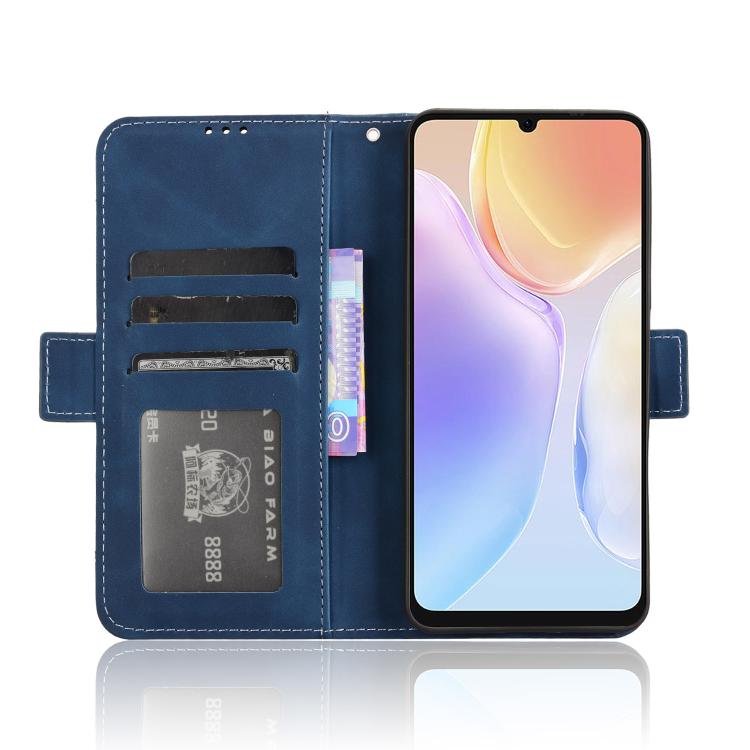 For Ulefone Note 20 Pro Skin Feel Calf Texture Card Slots Leather Phone Case(Blue) - Ulefone Cases by PMC TechLife | Online Shopping South Africa | PMC TechLife | Buy Now Pay Later Mobicred
