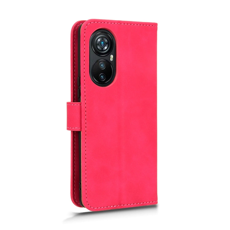 For Blackview A200 Pro Skin Feel Magnetic Flip Leather Phone Case(Rose Red) - More Brand by PMC Jewellery | Online Shopping South Africa | PMC Jewellery