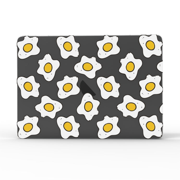 For MacBook Air 11.6 A1370 / A1465 UV Printed Pattern Laptop Frosted Protective Case(DDC-802) - free shipping - PMC Jewellery - Order now!