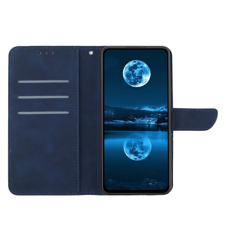 For Tecno Spark 40C Stitching Embossed Leather Phone Case(Blue) - free shipping - PMC TechLife - Order now!