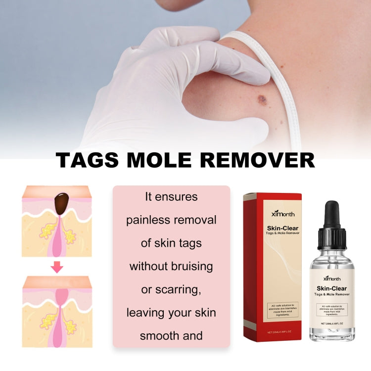 Ximonth 20ml/Bottle Anti Mole And Wart Liquid Dark Spot Tag Remover Skin Essence - free shipping - PMC TechLife - Order now!