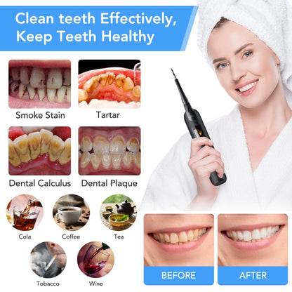 Dental Cleaning And Scaler Household Portable Electric Dental Care Tool Beauty Dental Instrument - Oral Irrigators by PMC Jewellery | Online Shopping South Africa | PMC Jewellery